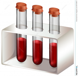 Test Tubes With Blood Samples Illustration 38709872 - Megapixl