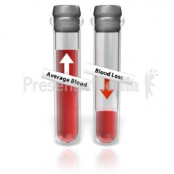 Test Tube Blood Loss - Science and Technology - Great Clipart for ...