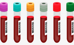 Blood Tube, Human Blood, Blood, Test Tube PNG Image and Clipart for ...