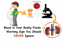 Blood-in-Your-Bodily-Fluids-Warning-Sign-You-Should-NEVER-Ignore ...