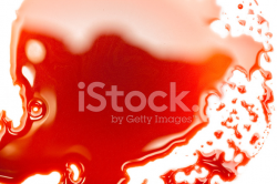 Puddle of Blood Stock Photos - FreeImages.com