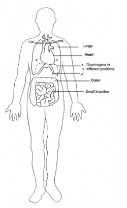 Human Body Diagram - Medical Clipart