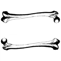 Arm Bone In Black And White About Broken Bones Clipart - Wikiclipart ...