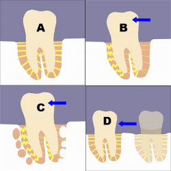 BIOLOGY OF TOOTH MOVEMENT