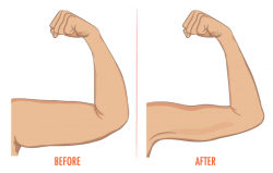 The Best Arm Exercises to Get Rid of Flabby Arms