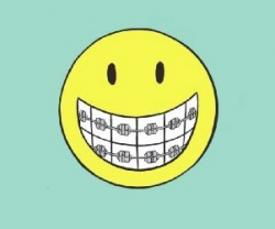 braces images clipart - Google Search | braces | Pinterest