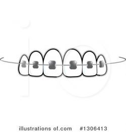Braces Clipart #1306413 - Illustration by Lal Perera