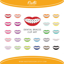 24 Dental Braces Clipart Set, Colorful Rainbow, Orthodontics Clip ...