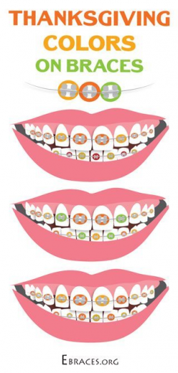 You Don't Have to Be a Genius to Choose Braces Colors