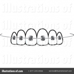 Braces Clipart #1306413 - Illustration by Lal Perera