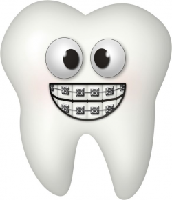 748 best My sweetlings' smiles images on Pinterest | Dental, Dental ...