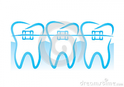 Dental Braces Clipart