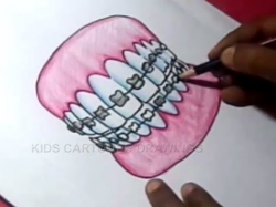How to Draw Orthodontics Teeth clips Drawing for kids - YouTube