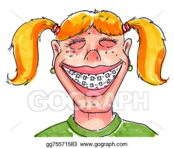 Stock Illustration - A girl with braces. Clipart Illustrations ...