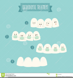 Orthodontic Braces Clipart | Free Images at Clker.com - vector clip ...