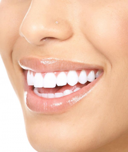81 best Love my smile images on Pinterest | Dental implants, Dental ...