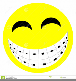 Smile With Braces Clipart | Free Images at Clker.com - vector clip ...