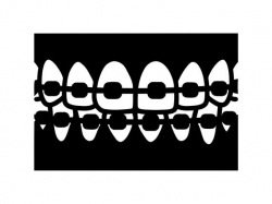 Braces Svg Teeth Svg Dentist Svg Dental Clipart silhouette Vector stencil  cut file cricut file, image