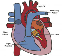 Brave heart | Science | dailyuw.com
