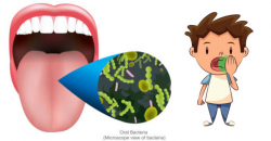Five Primary Causes of Bad Breath | Bloor Street Dental Blog