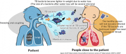 Tuberculosis transmission routes and unexpected sources of infection ...
