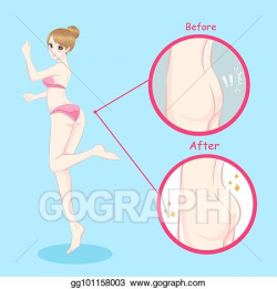 EPS Illustration - Woman with butt implant. Vector Clipart ...