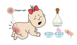 Home Remedies for Diaper Rash | Top 10 Home Remedies