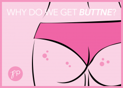 The Cheeky Facts About Butt Acne - The Pretty Pimple