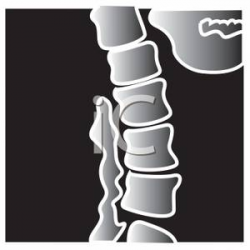 X-Ray Human Spine and Jaw Bones - Royalty Free Clipart Picture
