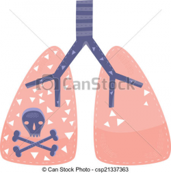 Lung Cancer Drawing at GetDrawings.com | Free for personal use Lung ...