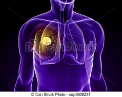Cancer clipart lung cancer - Pencil and in color cancer clipart lung ...