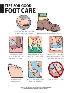 11 best diabetes foot care lab images on Pinterest | Feet care, Lab ...