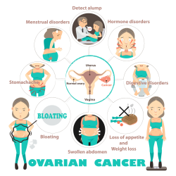 Ovarian Cancer Symptoms: how to tell if you have ovarian cancer ...