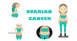 Ovarian cancer: What every woman needs to know - Read Health Related ...