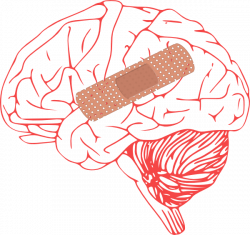Brain Injury Clip Art at Clker.com - vector clip art online, royalty ...