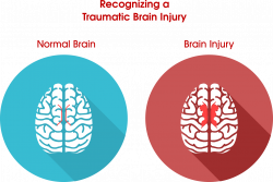 Head Injury PNG Transparent Head Injury.PNG Images. | PlusPNG