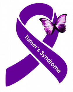 Turner's Syndrome occurs in 1 out of every 2,500 live female births ...