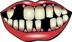 Smile Teeth Clipart (54+)