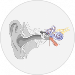 Hearing Loss | Modern Hearing and Choice Hearing