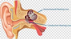 Ear Anatomy Middle ear Outer ear Inner ear, Outer Ear ...