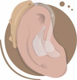 Hearing Loss - (A Complete Guide for 2018) - NRS Healthcare