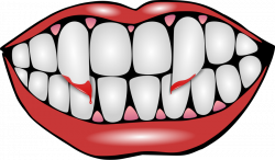 28+ Collection of Halloween Teeth Clipart | High quality, free ...