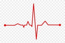Heart Rate, Bpm, Ecg, Ekg, Electrocardiogram, Ecg Waves ...