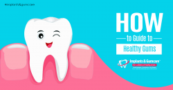 How to Guide to Healthy Gums | Things You Need to Know About ...