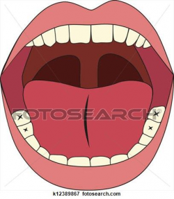 Free download Open Mouth Free Clipart for your creation ...