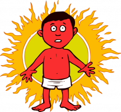 What you need to know about Sunburn - Plano Moms