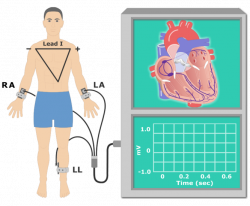 The Electrocardiogram (EKG or ECG)