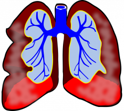 Here's Why Bronchitis Both Is and Isn't Contagious - RateMDs Health News