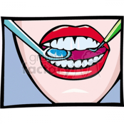 dental check up clipart. Royalty-free clipart # 166106
