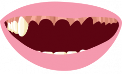 Missing teeth clip art clipart images gallery for free ...